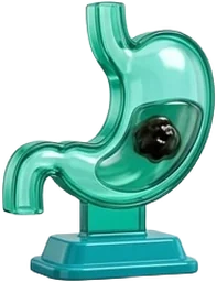 Cáncer de Estómago