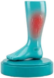 Celulitis Infecciosa