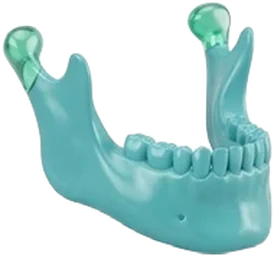 Cirugía Maxilofacial
