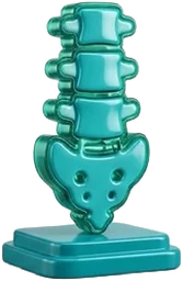 Espondilitis Anquilosante