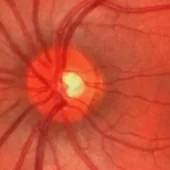 Foto de Dr. Bertha Olivia Martinez, Oftalmología en Tijuana