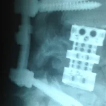 Foto de Dr. Jose Luis Pisano Gonzalez, Neurocirugía en Tijuana