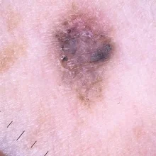 Foto de Dr. Virginia Susana Luna Magaña, Dermatología en Tijuana