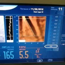 Foto de Dr. Álex Arturo de la Cruz Guillén, Gastroenterología en Tuxtla Gutiérrez