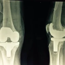 Foto de Dr. Romeo Ildefonso Sanchez Jiménez, Ortopedia y Traumatología en Tuxtla Gutiérrez