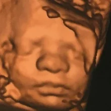 Foto de Dr. Oscar Aguirre Barrera, Ginecología y Obstetricia en Chihuahua