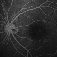 Foto de Dr. Victor Hugo Martinez Fierro, Oftalmología en Chihuahua