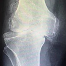 Foto de Dr. José Abraham De León Briviescas, Ortopedia y Traumatología en Torreón