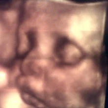 Foto de Dr. María Elena Herrera Delgadillo, Ginecología y Obstetricia en Torreón