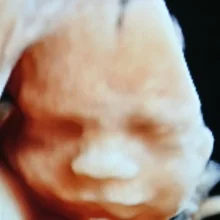 Foto de Dr. Pablo Lara Trevino, Ginecología y Obstetricia en Saltillo