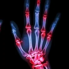 Foto de Dr. Argelia Perez Perez, Reumatología en Toluca