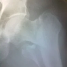 Foto de Dr. Salvador Gomez Rojas 2, Ortopedia y Traumatología en Toluca