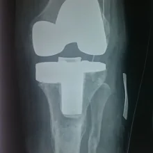 Foto de Dr. Alfredo Salcedo Gonzalez Jr., Ortopedia y Traumatología en León