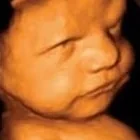 Foto de Dr. Arturo Garcia Witrago, Ginecología y Obstetricia en León