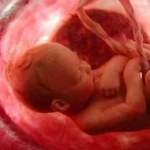 Foto de Dr. Francisco Fabricio Santoyo Huerta, Ginecología y Obstetricia en León