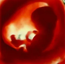 Foto de Dr. Francisco Javier Hernandez Machain, Cirugía General en Celaya