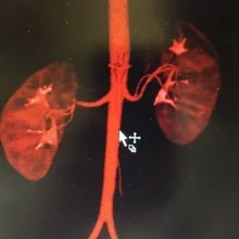 Foto de Dr. Javier Alberto Castillo Tapia, Nefrología en Acapulco