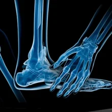 Foto de Dr. Jose Luis Hernandez Cortez, Ortopedia y Traumatología en Acapulco