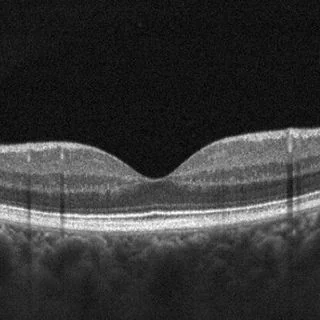Foto de Dr. Leonardo Méndez Suárez, Oftalmología en Pachuca