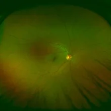 Foto de Dr. David Magaña García, Oftalmología en Morelia