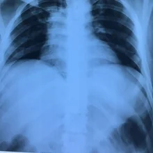 Foto de Dr. Jorge Luis Calderon Gonzalez, Cardiología en Cuernavaca