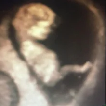 Foto de Dr. Maria Guadalupe Castañeda Ulloa, Ginecología y Obstetricia en Tepic