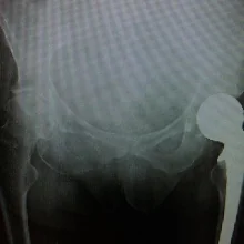 Foto de Dr. Raul Hassan Ramirez Rodriguez, Ortopedia y Traumatología en Monterrey