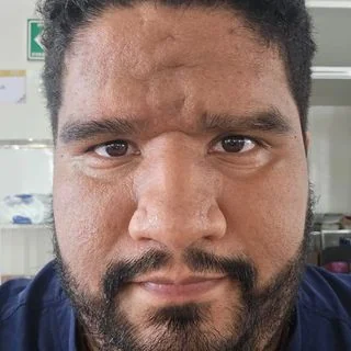 Foto de Dr. Fernando Raul Martinez Aguilar 2, Medicina Crítica en Xalapa