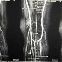 Foto de Dr. Hector Ruiz Mercado, Angiología y Cirugía Vascular en Zapopan