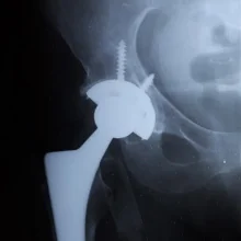 Foto de Dr. Jose Rosas Martin Del Campo, Ortopedia y Traumatología en Ciudad Juárez