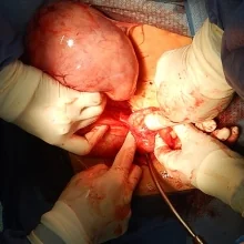 Foto de Dr. Oscar Pena Fuentes, Ginecología y Obstetricia en Xalapa