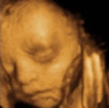 Foto de Dr. Rodrigo Lopez Saltijeral, Ginecología y Obstetricia en Ciudad Juárez