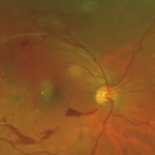 Foto de Dr. Francisco Romero Rodriguez, Oftalmología en Puebla