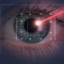 Foto de Dr. Miguel Angel Lagunas Ramirez 2, Oftalmología en Puebla