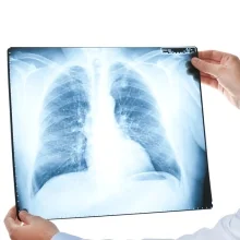 Foto de Dr. Saúl Sánchez Romero, Neumología en Puebla