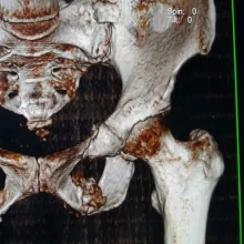 Foto de Dr. Victor Martínez Delgado, Ortopedia y Traumatología en Puebla