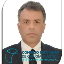Foto de Dr. Mario Quijano Hernandez plástico, Santiago De Querétaro, Cirugía Plástica y Reconstructiva en Querétaro