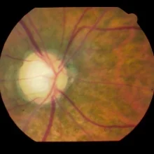 Foto de Dr. Kathia Oliver, Oftalmología en Cancún