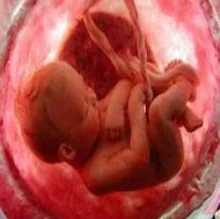 Foto de Dr. Jose Rosario Acosta Castaneda, Ginecología y Obstetricia en Culiacán