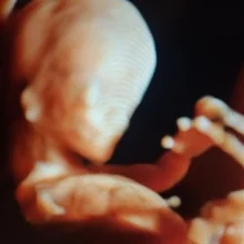 Foto de Dr. Paul Alberto Sandoval Quinonez 2, Ginecología y Obstetricia en Los Mochis