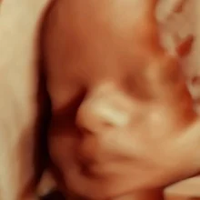 Foto de Dr. Edna Jimenez Ibarra, Ginecología y Obstetricia en Hermosillo