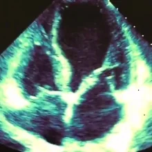 Foto de Dr. Paulina Orosa Fernández, Cardiología en Veracruz