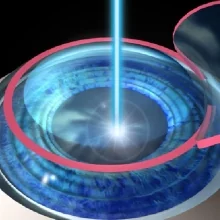 Foto de Dr. Angel Israel Perez Garcia 2, Oftalmología en Mérida